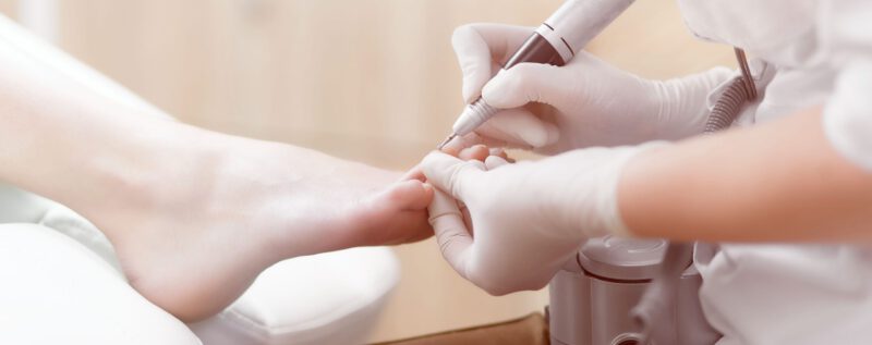 Nagelprothetik beschädigte Nägel Podologie Berline Podologe