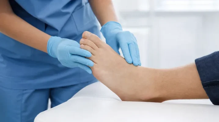 Podologin untersucht einen Fuß auf Schwellung und Überwärmung als Anzeichen für einen Charcot-Fuß