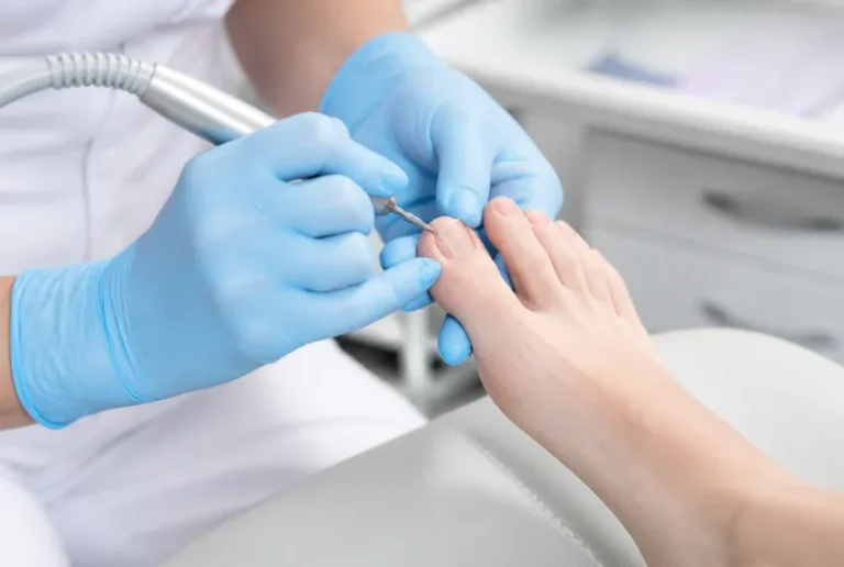 Podologische Komplexbehandlung: Leistung, Kosten und wann die Krankenkasse zahlt