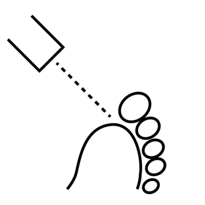 Icon laser